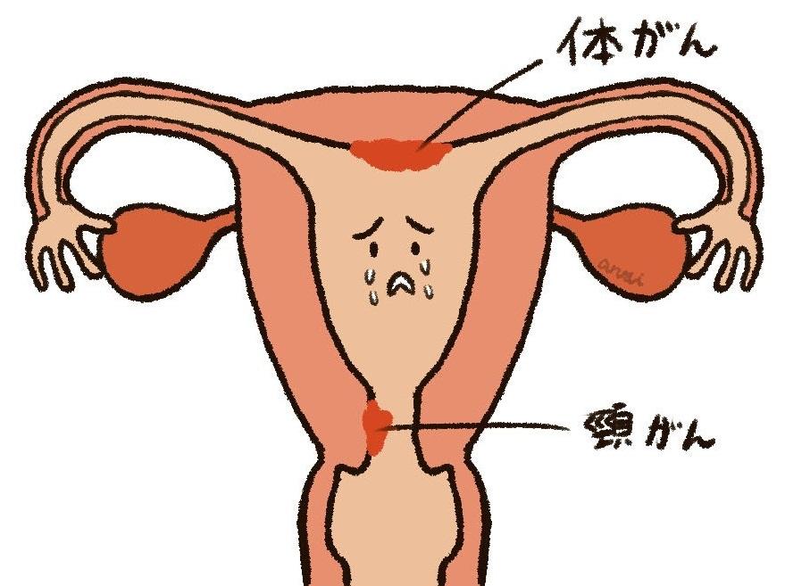 女性のがん健診